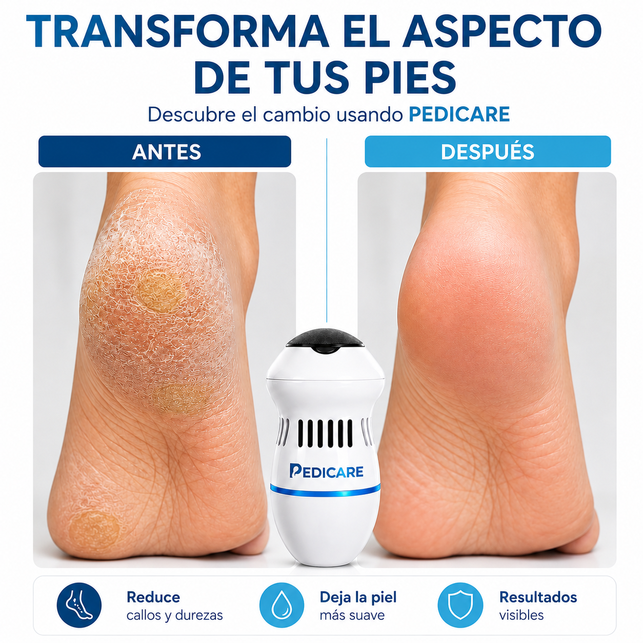 PEDICARE® REMOVEDOR ELÉCTRICO DE CALLOS – ELIMINA DUREZAS EN SEGUNDOS