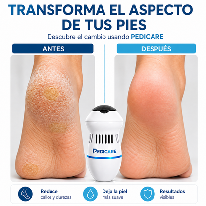 PEDICARE® REMOVEDOR ELÉCTRICO DE CALLOS – ELIMINA DUREZAS EN SEGUNDOS